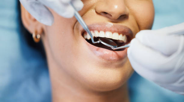 Best Chipped Tooth Repair Near Me  in Dale, PA