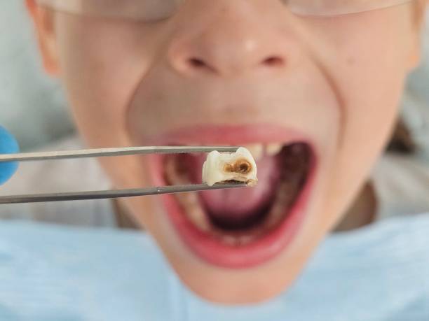 Best Chipped Tooth Repair Near Me  in Dale, PA